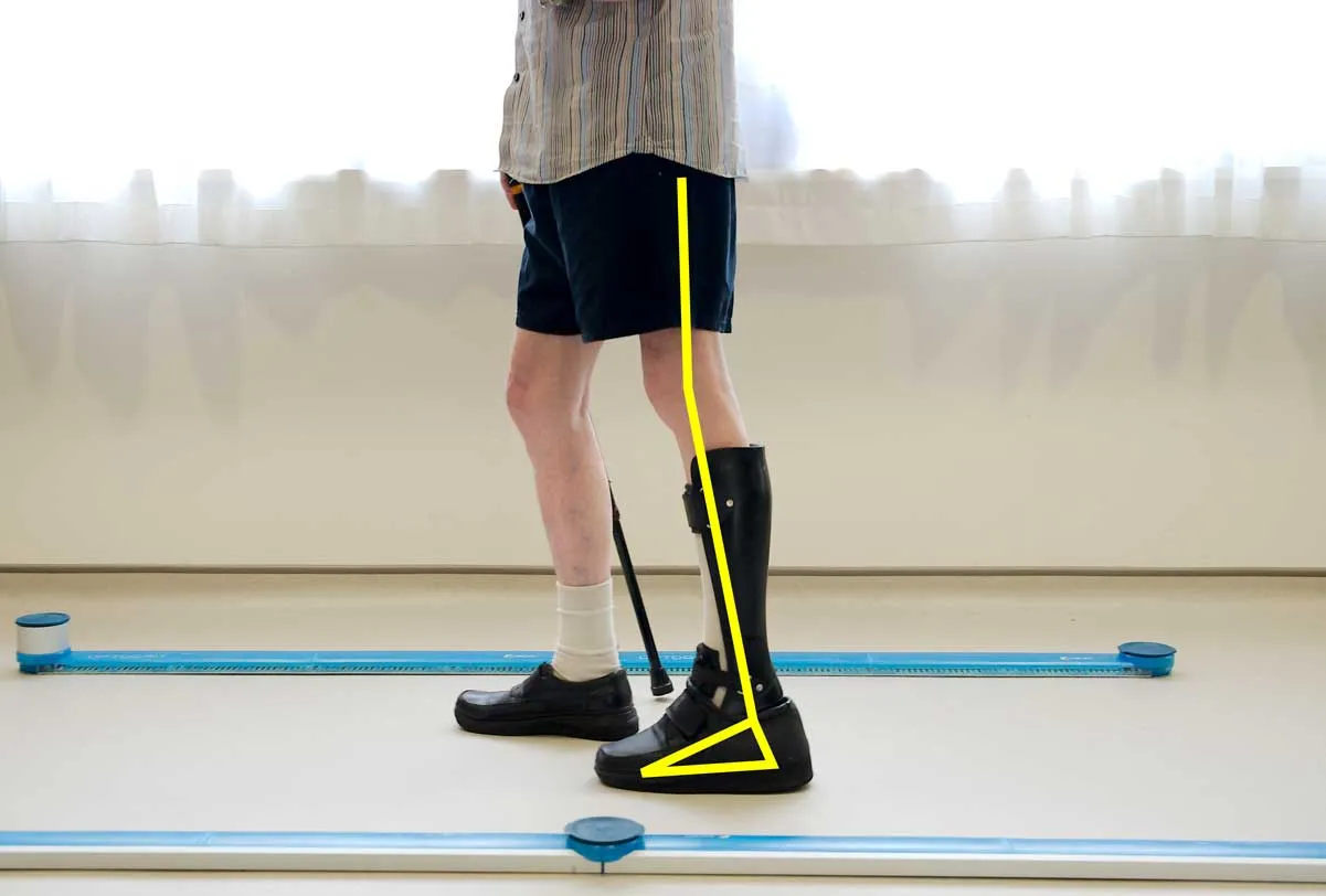 Gait Analysis 2